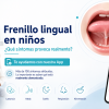 frenillo lingual sintomas